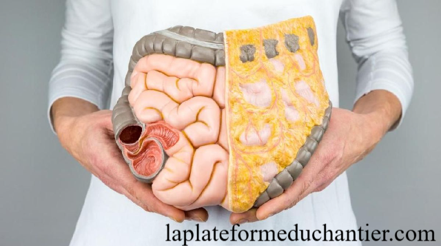 Kanker Usus Melonjak di Usia Muda, Apa Pemicunya?